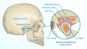What is TMJ