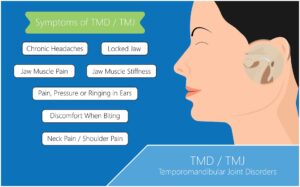 Symptoms of TMJ Dysfunction