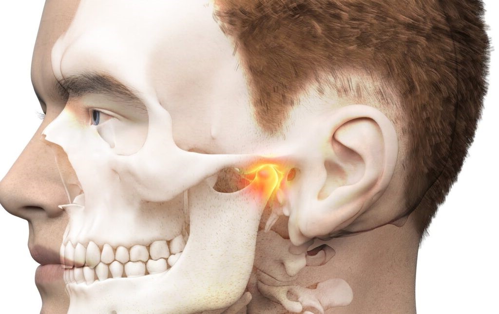 Unlocking the Mystery of TMJ Disorders: Frequently Asked Questions and Expert Answers